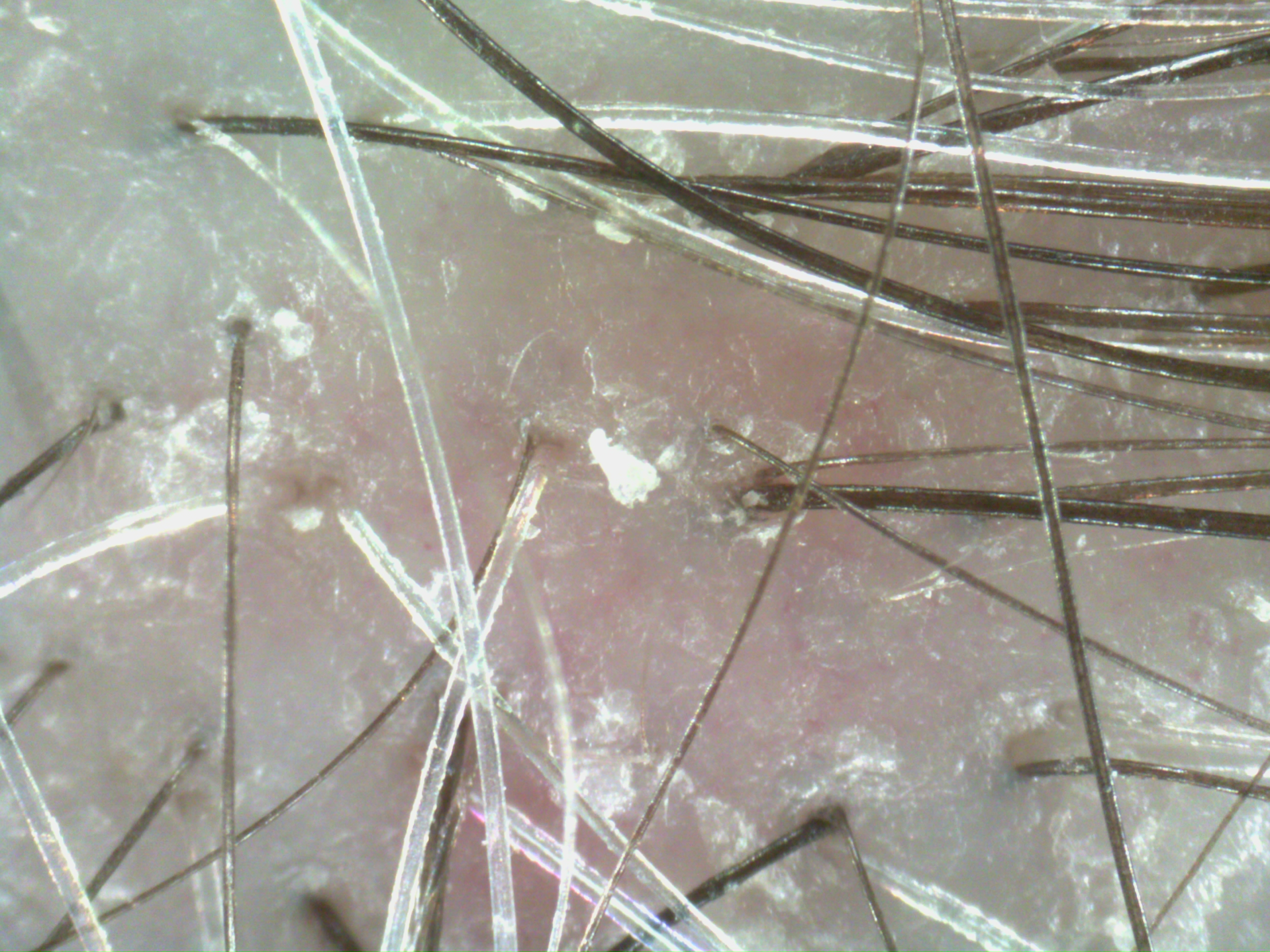 Kruche, łamliwe włosy