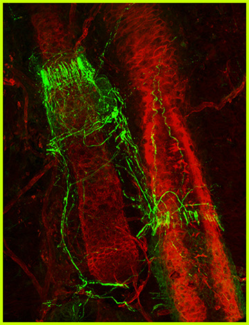 Układ nerwowy mieszka włosowego