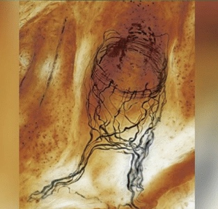 Układ nerwowy mieszka włosówego